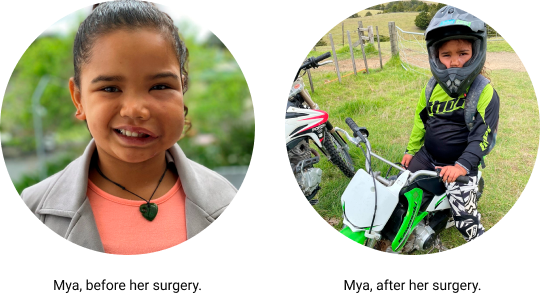 Photos of Mya before and after her surgery