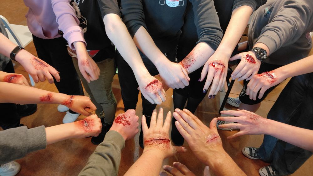 Group of people's hands wearing special effects make-up to look like injuries